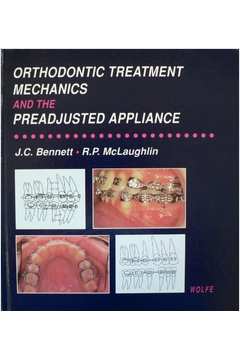  Tratamento Ortodontico No Adulto: 9788530300548