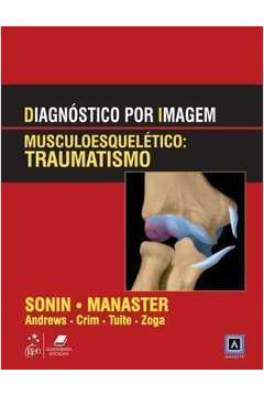 Diagnostico por Imagem - Musculoesqueletico - Traumatismo